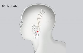 You are currently viewing Neuralink “Show & Tell” Coming on November 30th, Hints at Thought-controlled Typing
<span class="bsf-rt-reading-time"><span class="bsf-rt-display-label" prefix=""></span> <span class="bsf-rt-display-time" reading_time="1"></span> <span class="bsf-rt-display-postfix" postfix="min read"></span></span><!-- .bsf-rt-reading-time -->